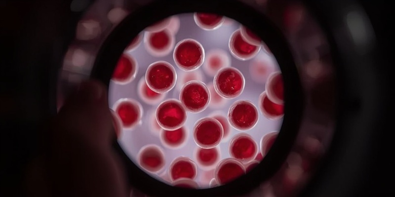 Erytrocyty w moczu – co oznacza ich obecność i kiedy iść do lekarza?